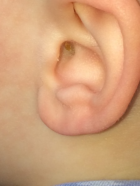 ear wax!