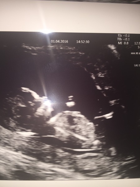 Thread #4 - TTC#1 the one where Stark joins the grads!!!!