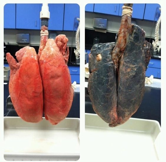 To ask you all to remind me why i must not smoke?