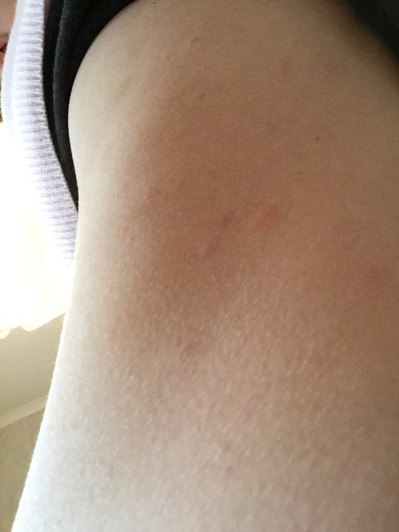 Spots - HELP!!!!