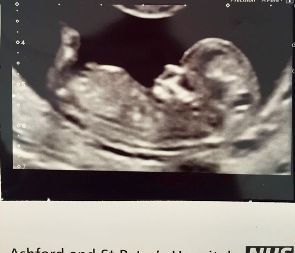 Guess the gender!