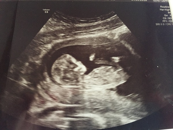 October 2016 (thread number four). Entering the second trimester.