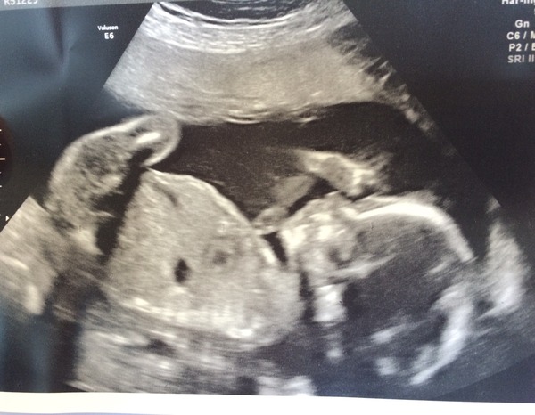 Thread #5 - TTC#1 grads thread - now we're cooking with charcoal!