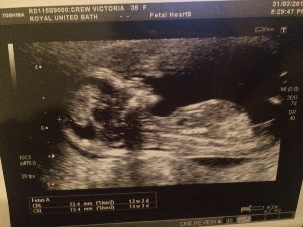 October 2016. Thread 3 - Booking In and Dating Scans!