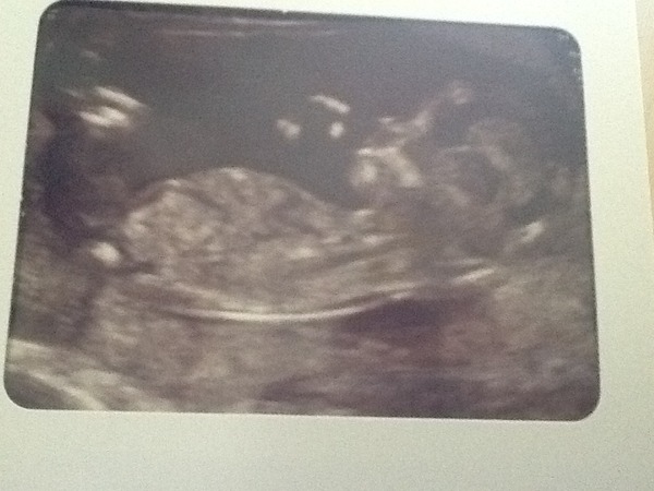 October 2016. Thread 3 - Booking In and Dating Scans!