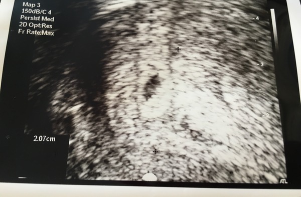 December 2016... Babies