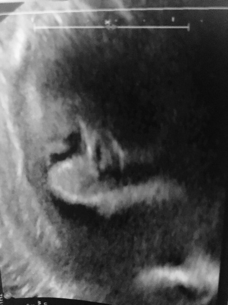 June #8 Kicks, rolls and thwacks! Need help putting socks on! Living off of chocolate! Its the last trimester people!!!!