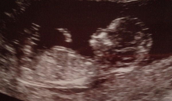 Thread #5 - TTC#1 grads thread - now we're cooking with charcoal!