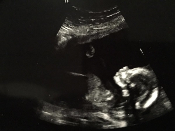 Thread #5 - TTC#1 grads thread - now we're cooking with charcoal!