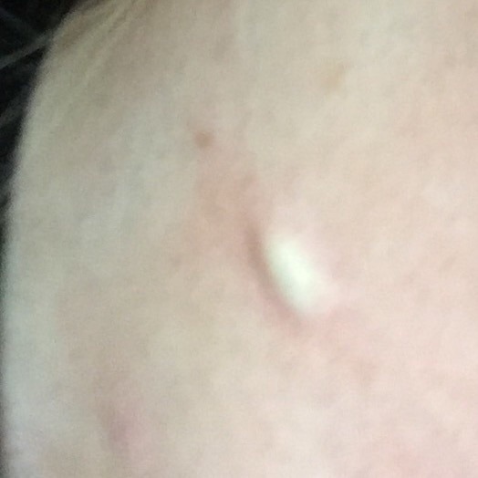 KLAXON! 4 year old lump