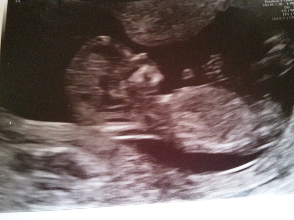 Thread #4 - TTC#1 the one where Stark joins the grads!!!!