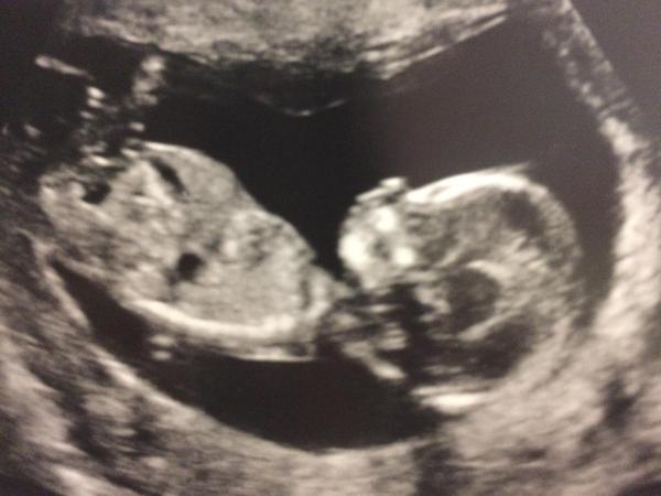 October 2016. Thread 3 - Booking In and Dating Scans!