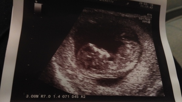 October 2016 (thread number four). Entering the second trimester.