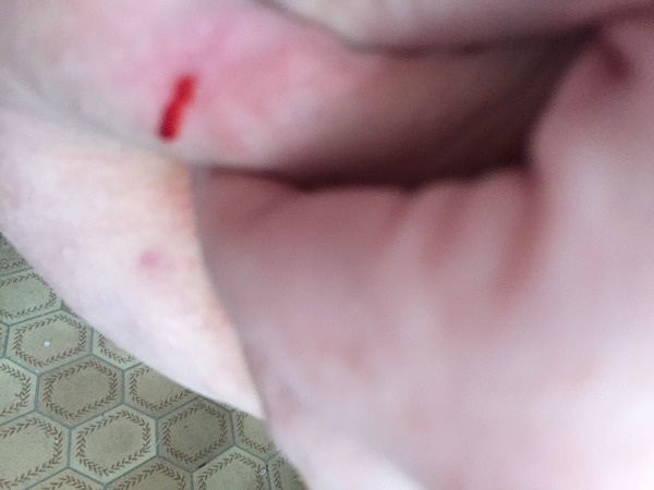 I am sorry I have sinned....