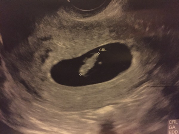 Thread #5 - TTC#1 grads thread - now we're cooking with charcoal!