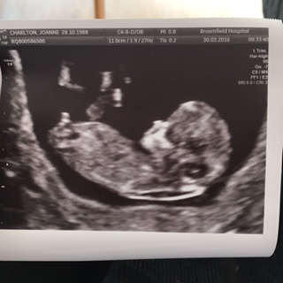 Help 12 week scan pic boy or girl? xx