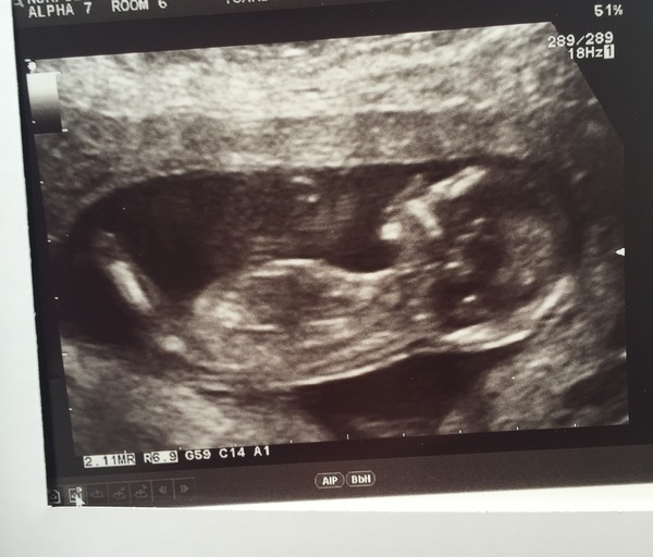 October 2016. Thread 3 - Booking In and Dating Scans!