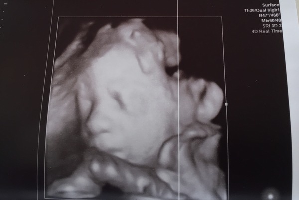 July 2016 Babies (8) - 3rd trimester here we come