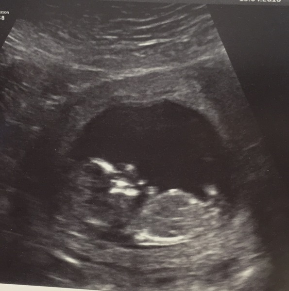 Thread #5 - TTC#1 grads thread - now we're cooking with charcoal!