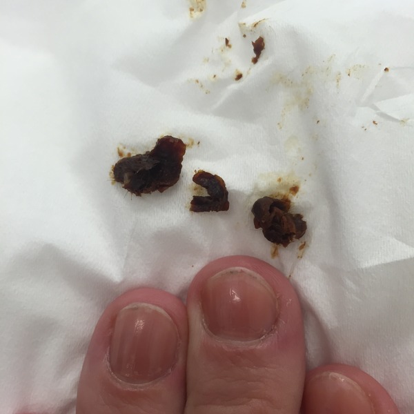 Having my ears hoovered out tomorrow and I'm SO excited