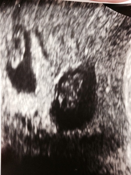 Staying posifrickentive- Thread 8 for ladies after mc