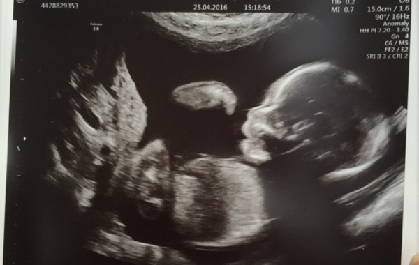 September 2016 - End of pregnancy sickness is in sight....please!