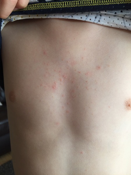 yet another what's this rash thread! :)