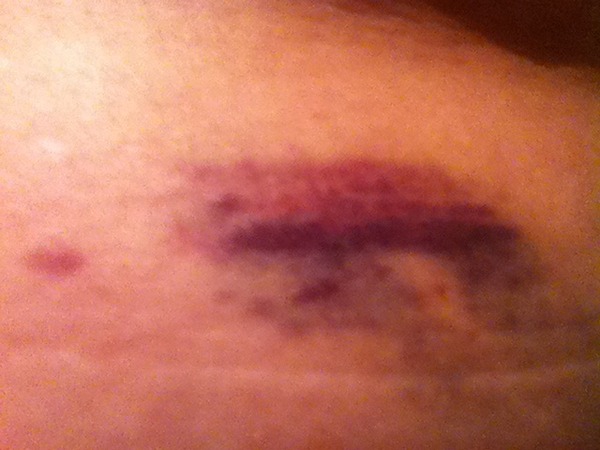 Going through IVF in February?