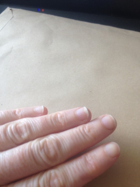nails separating from nail bed when I wear polish, is there anything I can do?