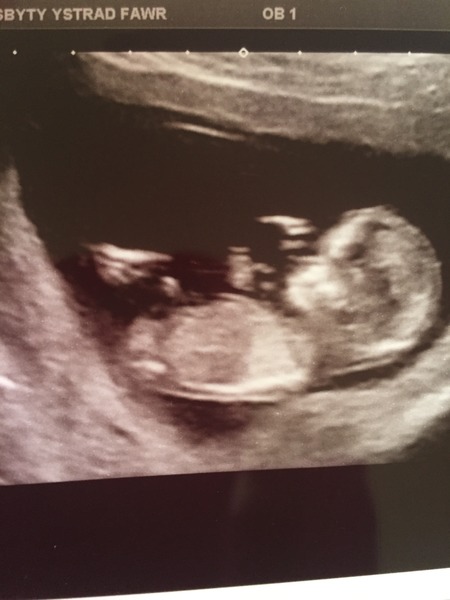 October 2016 (thread number four). Entering the second trimester.