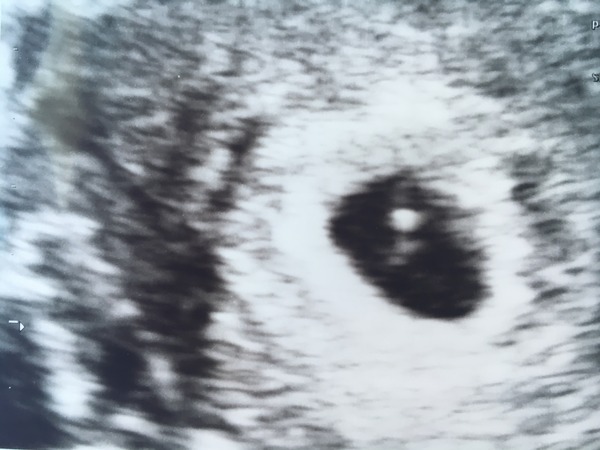 December due date buddies!