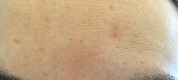 How can I perk up my skin