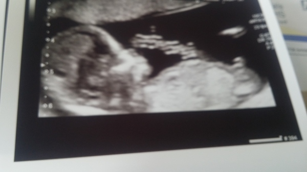 October 2016. Thread 3 - Booking In and Dating Scans!