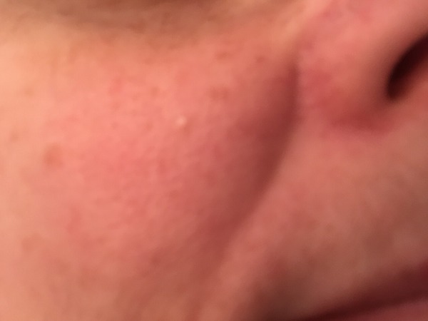 odd white "spot" on face?