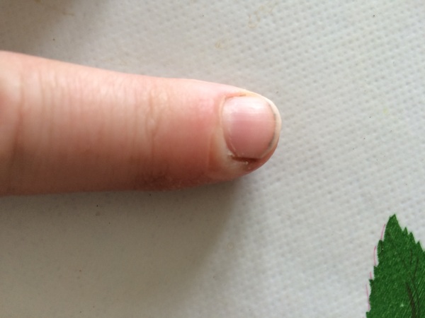 KLAXON! stand back!! it's gonna blow!