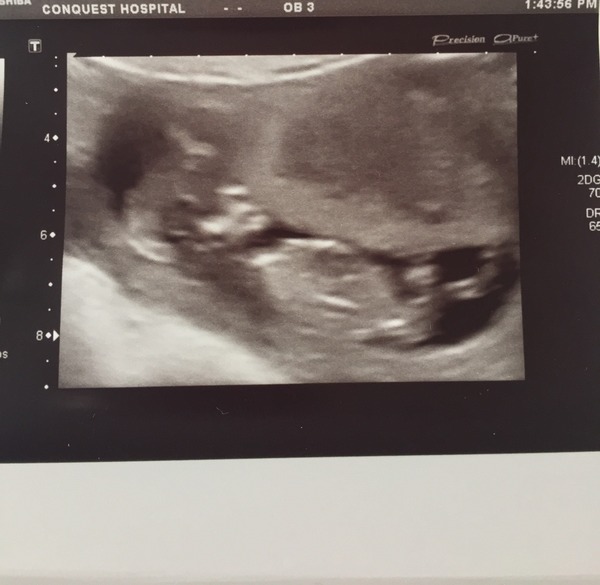 Staying posifrickentive- Thread 8 for ladies after mc