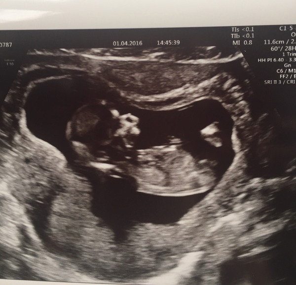 Thread #5 - TTC#1 grads thread - now we're cooking with charcoal!