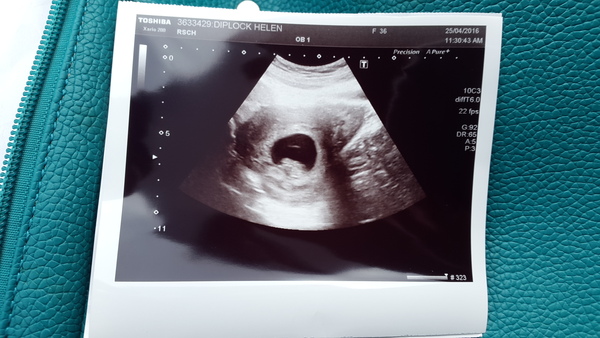 Morning sickness and first scan anticipation - it's the December 2016 babies.