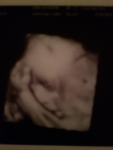 June #8 Kicks, rolls and thwacks! Need help putting socks on! Living off of chocolate! Its the last trimester people!!!!