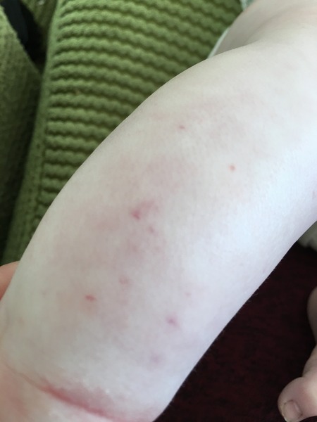 AIBU to want to buy a new cot because of these spots on dd?