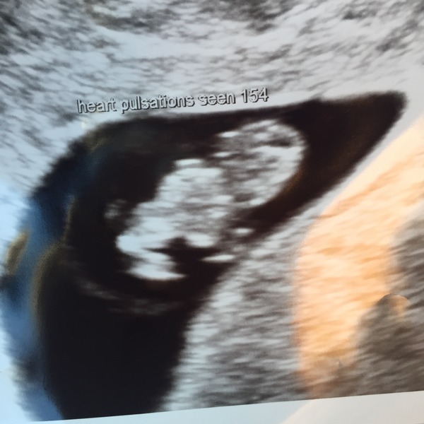 December 2016... Babies