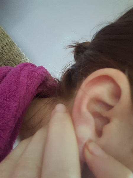 KLAXON pea sized lump in earlobe, with pics of course.