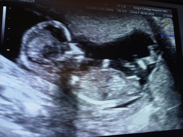 Thread #4 - TTC#1 the one where Stark joins the grads!!!!