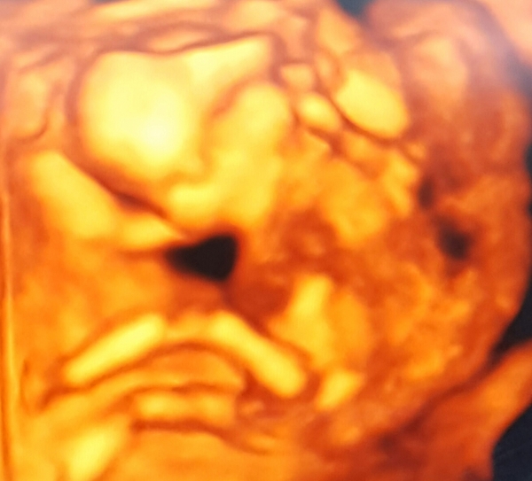 Thread #5 - TTC#1 grads thread - now we're cooking with charcoal!