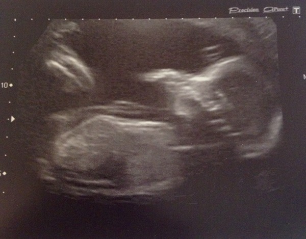 Thread #5 - TTC#1 grads thread - now we're cooking with charcoal!