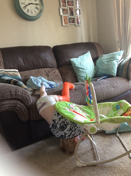 Broken leg in 3 year old: what to expect?