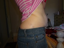 A year of running - before and after pics