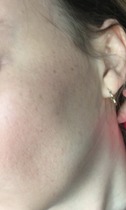 What is this on my face?!?!
