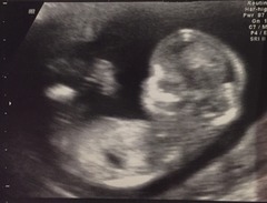 Boy or girl what do you think? just curious :D