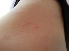 Spots - HELP!!!!